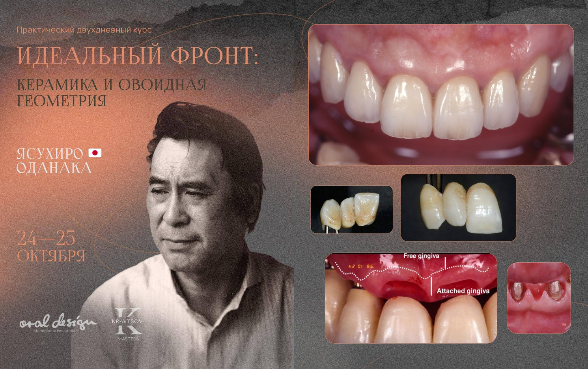 Практический курс "Идеальный фронт: керамика и овоидная геометрия"