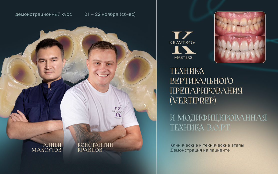 Техника Вертикального Препарирования (Vertiprep) и модифицированная техника B.O.P.T. Демонстрация на пациенте