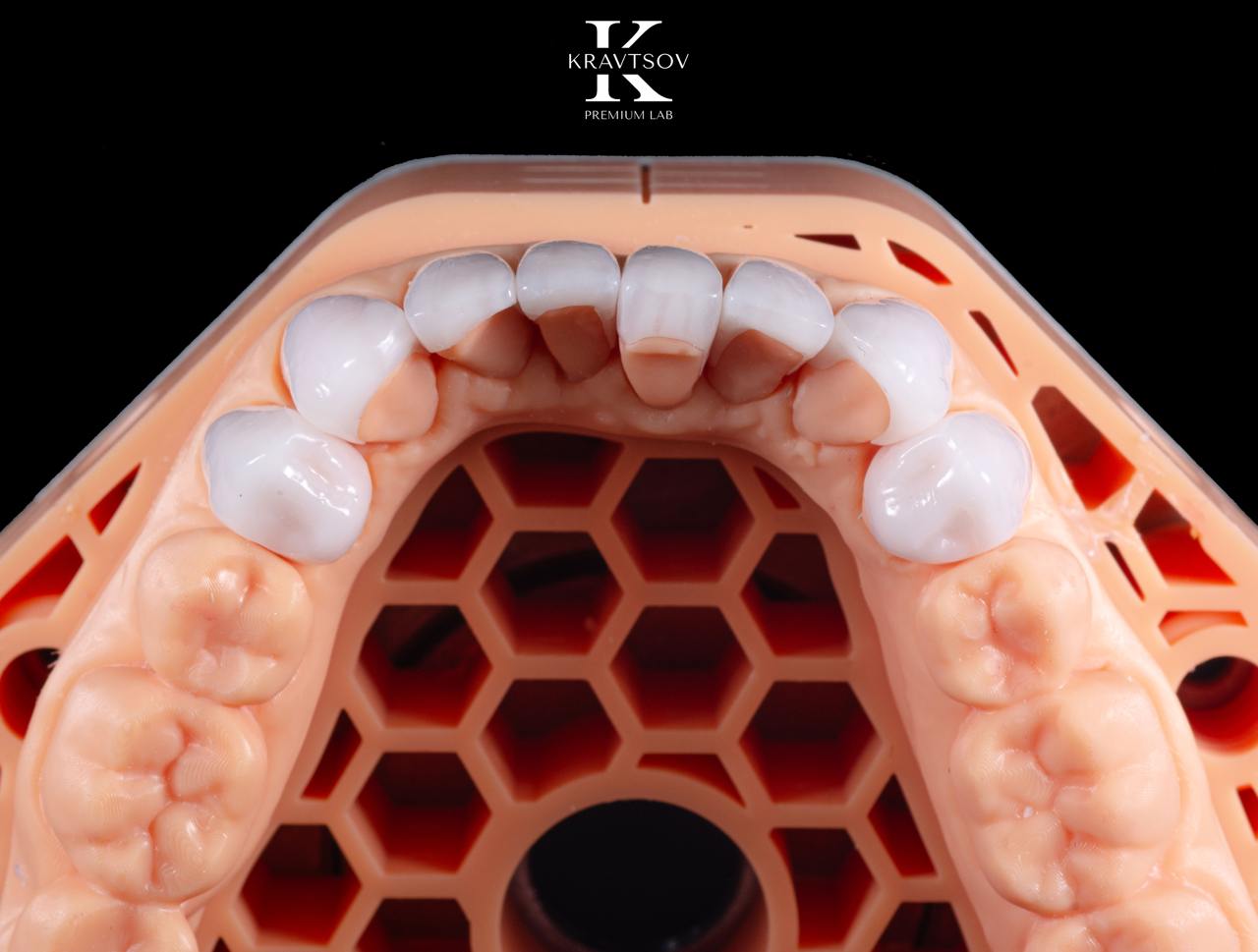 Второй поток курса по 3D-печати: пошаговый алгоритм цифрового рабочего процесса 