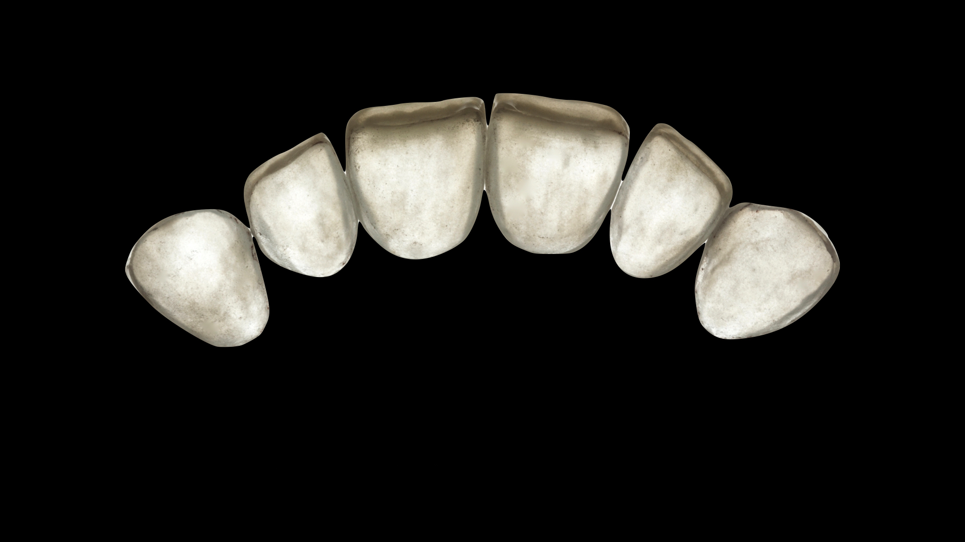 Практический курс " Виниры на рефракторе. IPS e.max Ceram"