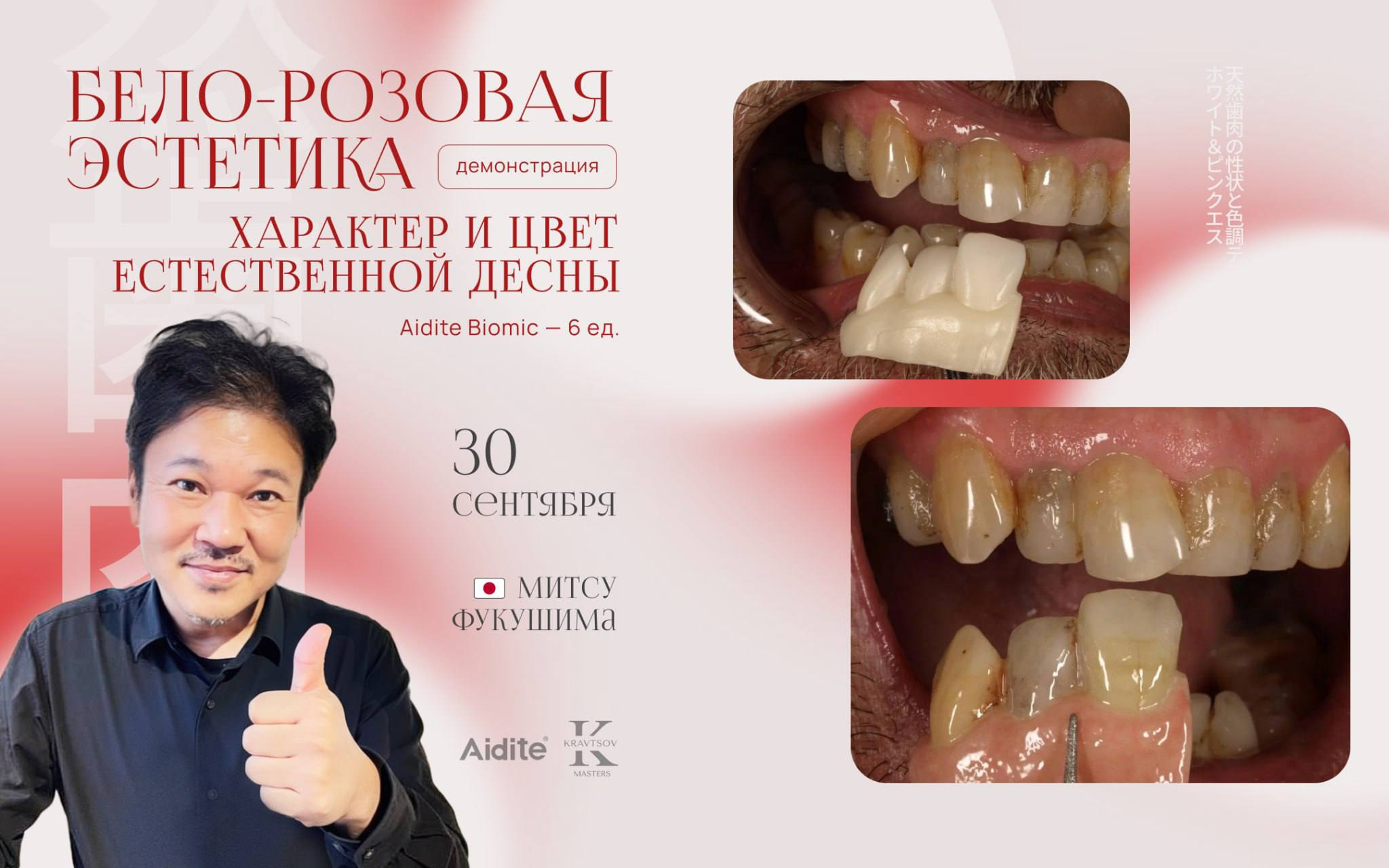Бело-розовая эстетика: характер и цвет естественной десны
